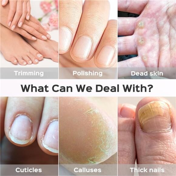 Professional Manicure Pedicure Kit:5 in 1 Electric Nail File Set Toenail Grinder - Picture 6 of 7